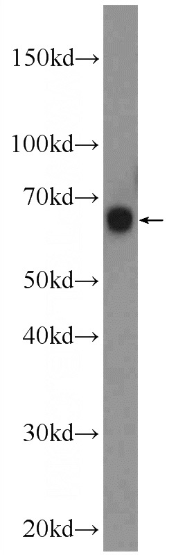 rat testis tissue were subjected to SDS PAGE followed by western blot with Catalog No:112105(KLHL34 Antibody) at dilution of 1:600
