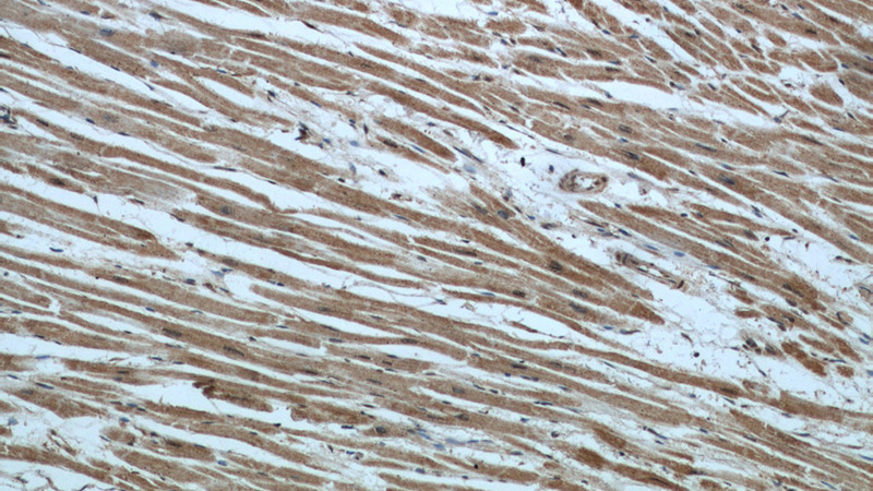 Immunohistochemical of paraffin-embedded human heart using Catalog No:116523(UBE2E3 antibody) at dilution of 1:50 (under 10x lens)