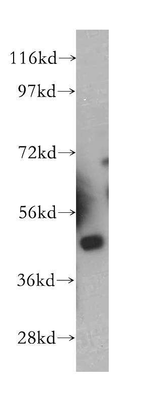 A549 cells were subjected to SDS PAGE followed by western blot with Catalog No:114140(PPME1 antibody) at dilution of 1:300