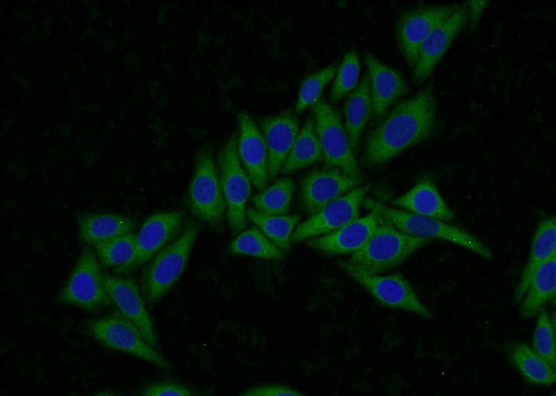 Immunofluorescent analysis of HepG2 cells using Catalog No:108258(ADPRHL2 Antibody) at dilution of 1:50 and Alexa Fluor 488-congugated AffiniPure Goat Anti-Rabbit IgG(H+L)
