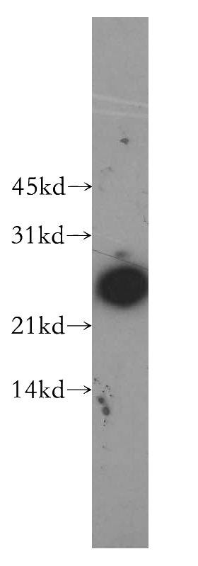 HeLa cells were subjected to SDS PAGE followed by western blot with Catalog No:115459(SNRPB2 antibody) at dilution of 1:500
