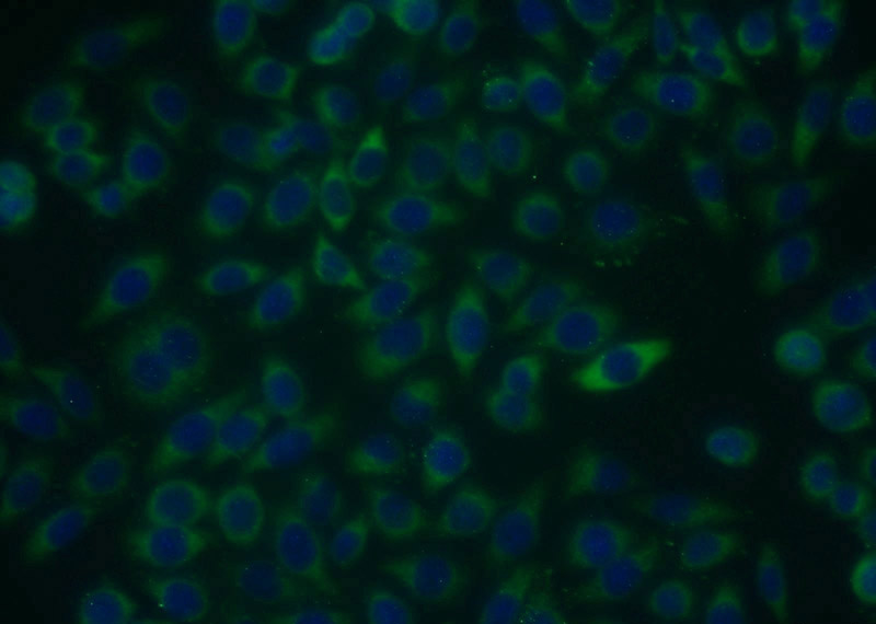 Immunofluorescent analysis of MCF-7 cells using Catalog No:114713(RIOK3 Antibody) at dilution of 1:25 and Alexa Fluor 488-congugated AffiniPure Goat Anti-Rabbit IgG(H+L)