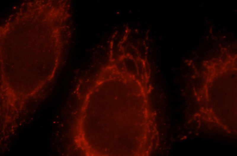 Immunofluorescent analysis of MCF-7 cells, using Sik1 antibody Catalog No:115230 at 1:25 dilution and Rhodamine-labeled goat anti-rabbit IgG (red).