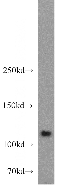 HeLa cells were subjected to SDS PAGE followed by western blot with Catalog No:111314(HGS antibody) at dilution of 1:800