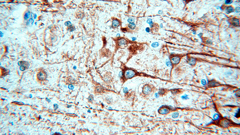 Immunohistochemical of paraffin-embedded human brain using Catalog No:112474(MAP2 antibody) at dilution of 1:100 (under 40x lens). Heat mediated antigen retrieved with Citric acid buffer, pH6.0.