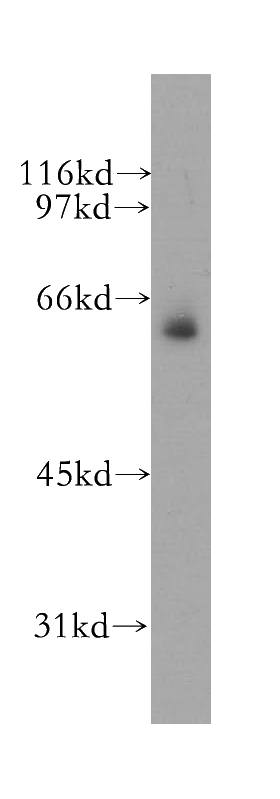 mouse skeletal muscle tissue were subjected to SDS PAGE followed by western blot with Catalog No:112873(MSL3 antibody) at dilution of 1:500