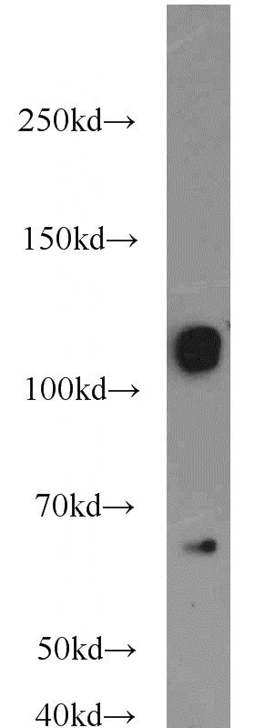 HeLa cells were subjected to SDS PAGE followed by western blot with Catalog No:108904(CAST antibody) at dilution of 1:1000