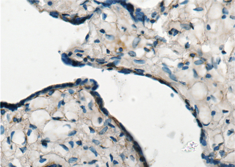 Immunohistochemistry of paraffin-embedded human placenta tissue slide using Catalog No:110306(EDNRB Antibody) at dilution of 1:50 (under 40x lens)