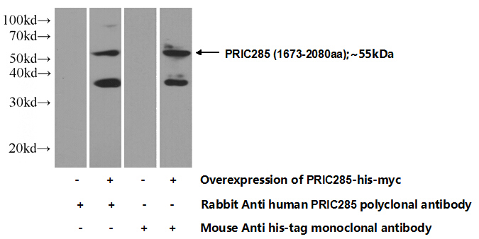 Transfected HEK-293 cells were subjected to SDS PAGE followed by western blot with Catalog No:114189(PRIC285 Antibody) at dilution of 1:500