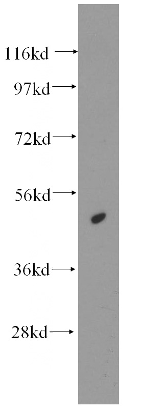 MCF7 cells were subjected to SDS PAGE followed by western blot with Catalog No:111260(HAT1 antibody) at dilution of 1:500