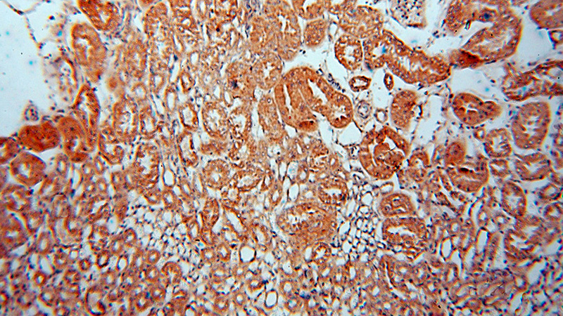 Immunohistochemical of paraffin-embedded human kidney using Catalog No:116346(TRAPPC9,NIBP antibody) at dilution of 1:50 (under 10x lens)