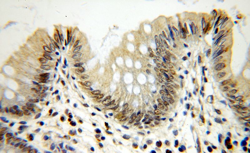 Immunohistochemical of paraffin-embedded human colon using Catalog No:112763(MTA2 antibody) at dilution of 1:100 (under 40x lens)