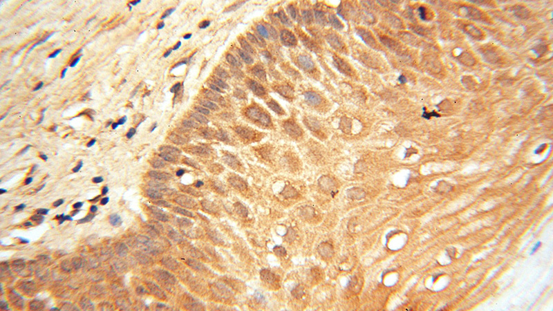 Immunohistochemical of paraffin-embedded human cervix using Catalog No:112265(LACTB2 antibody) at dilution of 1:100 (under 40x lens)