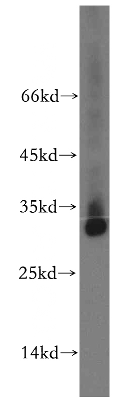 mouse skeletal muscle tissue were subjected to SDS PAGE followed by western blot with Catalog No:116186(TMEM38A antibody) at dilution of 1:400