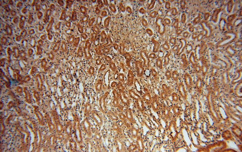 Immunohistochemical of paraffin-embedded human kidney using Catalog No:116538(UBE2U antibody) at dilution of 1:50 (under 10x lens)