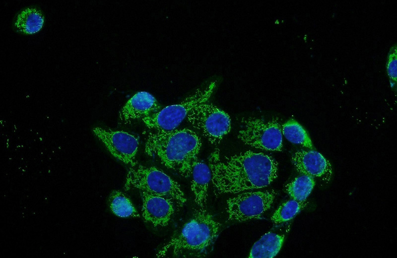 Immunofluorescent analysis of A431 cells using Catalog No:114407(RAB11FIP1 Antibody) at dilution of 1:50 and Alexa Fluor 488-congugated AffiniPure Goat Anti-Rabbit IgG(H+L)
