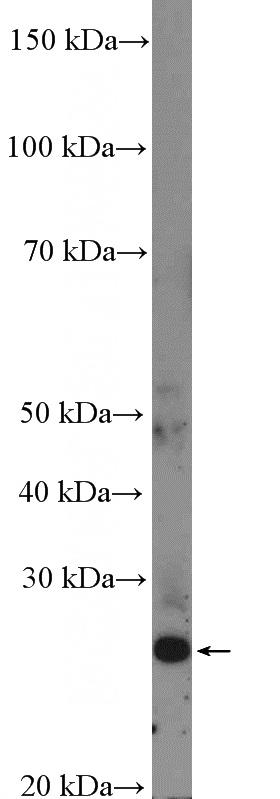 DU 145 cells were subjected to SDS PAGE followed by western blot with Catalog No:110688(FLJ14213 Antibody) at dilution of 1:300