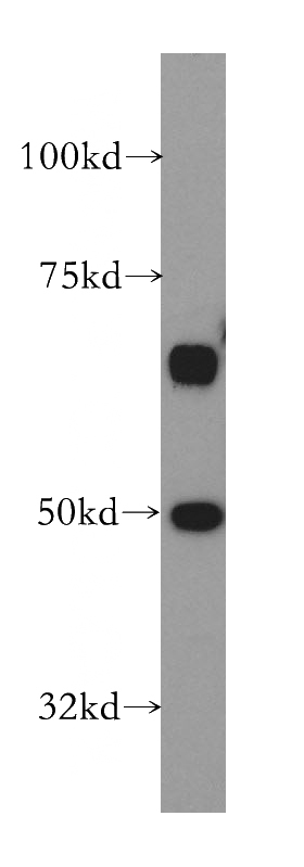 HeLa cells were subjected to SDS PAGE followed by western blot with Catalog No:115713(STK24 antibody) at dilution of 1:400