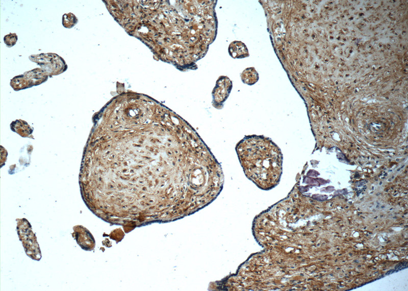 Immunohistochemistry of paraffin-embedded human placenta tissue slide using Catalog No:113892(PGF Antibody) at dilution of 1:50 (under 10x lens)
