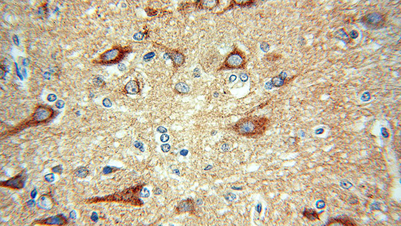 Immunohistochemical of paraffin-embedded human brain using Catalog No:114982(SCAMP1 antibody) at dilution of 1:100 (under 40x lens)