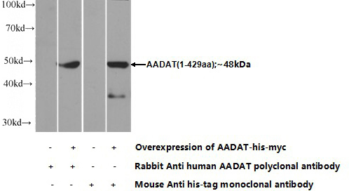 Transfected HEK-293 cells were subjected to SDS PAGE followed by western blot with Catalog No:107671(AADAT Antibody) at dilution of 1:350