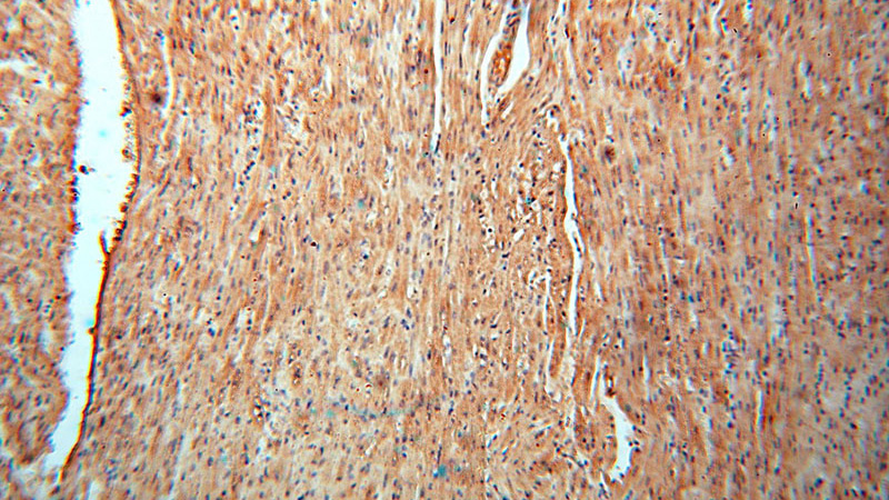 Immunohistochemical of paraffin-embedded human heart using Catalog No:109669(CCNI antibody) at dilution of 1:50 (under 10x lens)
