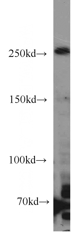 HeLa cells were subjected to SDS PAGE followed by western blot with Catalog No:114526(RAI1 antibody) at dilution of 1:500