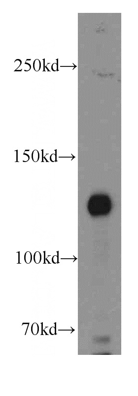mouse kidney tissue were subjected to SDS PAGE followed by western blot with Catalog No:116160(TNS3 antibody) at dilution of 1:100