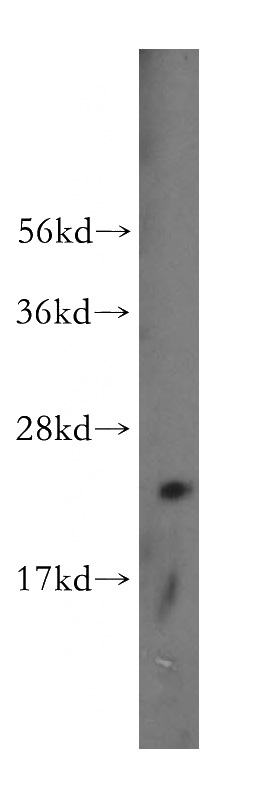human colon tissue were subjected to SDS PAGE followed by western blot with Catalog No:116334(TRANSGELIN-1-specific antibody) at dilution of 1:100