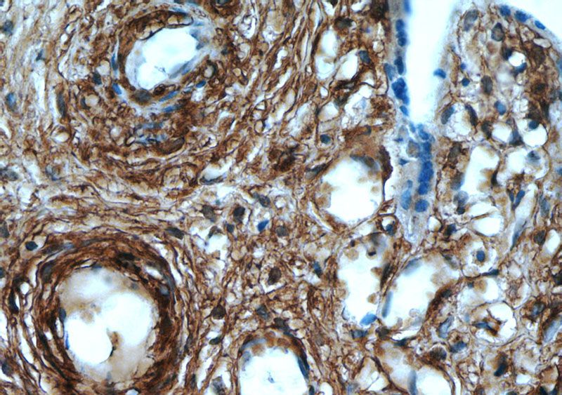 Immunohistochemistry of paraffin-embedded human placenta tissue slide using Catalog No:107930(AKAP12 Antibody) at dilution of 1:50 (under 40x lens)