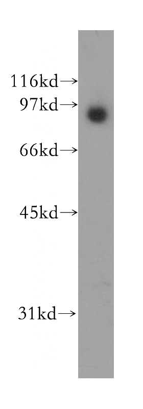 human cerebellum tissue were subjected to SDS PAGE followed by western blot with Catalog No:116393(NTRK2 antibody) at dilution of 1:400