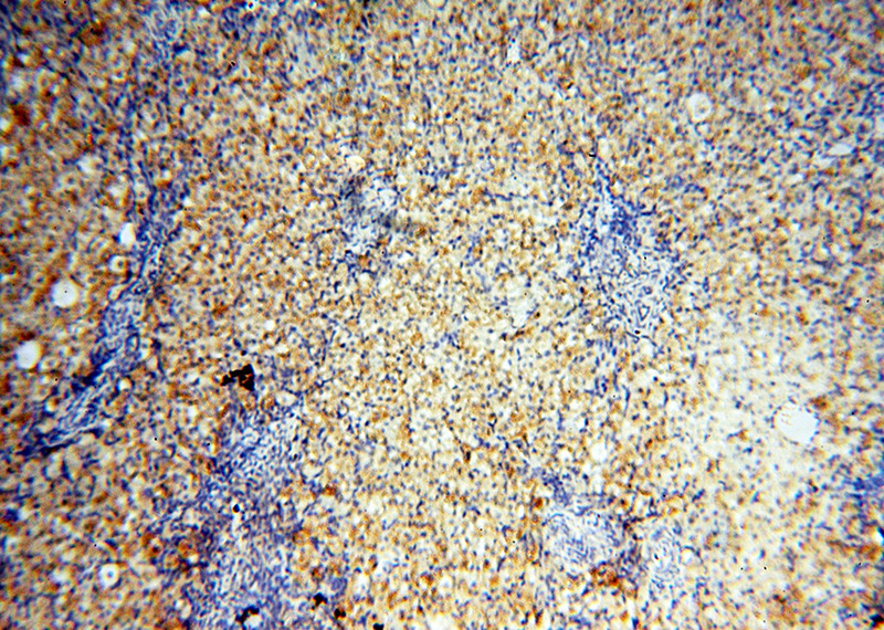 Immunohistochemical of paraffin-embedded human ovary using Catalog No:111120(GPR177 antibody) at dilution of 1:100 (under 10x lens)