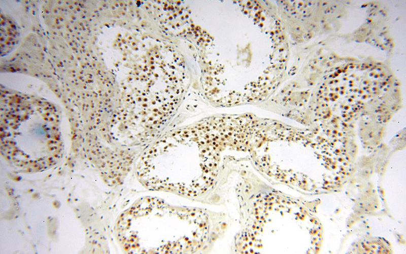 Immunohistochemical of paraffin-embedded human testis using Catalog No:116839(WRAP53 antibody) at dilution of 1:100 (under 10x lens)