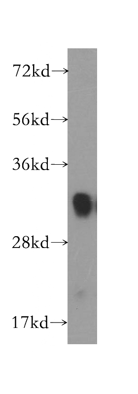 human brain tissue were subjected to SDS PAGE followed by western blot with Catalog No:110649(FHL1 antibody) at dilution of 1:1000