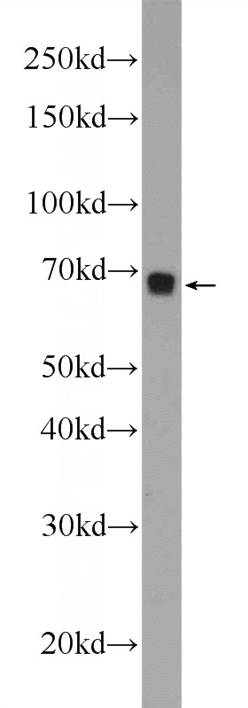 NIH/3T3 cells were subjected to SDS PAGE followed by western blot with Catalog No:110694(FOXD4 Antibody) at dilution of 1:1000