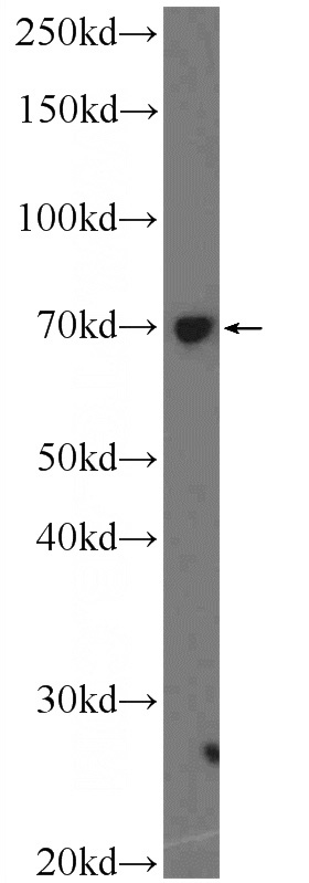 HeLa cells were subjected to SDS PAGE followed by western blot with Catalog No:113161(NFKBIZ Antibody) at dilution of 1:300