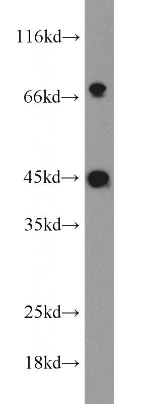 SGC-7901 cells were subjected to SDS PAGE followed by western blot with Catalog No:116835(WNT3 antibody) at dilution of 1:600