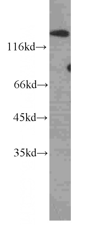 MCF7 cells were subjected to SDS PAGE followed by western blot with Catalog No:107043(SDC1,CD138 antibody) at dilution of 1:500