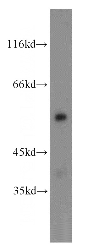 mouse lung tissue were subjected to SDS PAGE followed by western blot with Catalog No:109704(CYP4B1 antibody) at dilution of 1:500