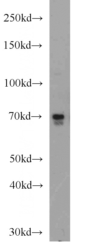 HeLa cells were subjected to SDS PAGE followed by western blot with Catalog No:110280(ELL antibody) at dilution of 1:1000