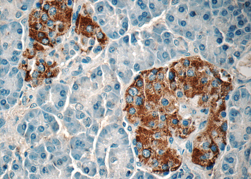 Immunohistochemistry of paraffin-embedded human pancreas tissue slide using Catalog No:108015(Amylin Antibody) at dilution of 1:50 (under 40x lens)