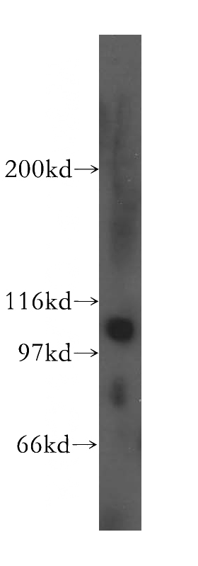 PC-3 cells were subjected to SDS PAGE followed by western blot with Catalog No:110317(EEF2K antibody) at dilution of 1:400