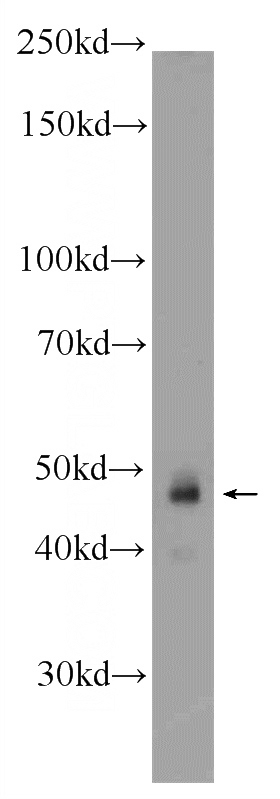 HeLa cells were subjected to SDS PAGE followed by western blot with Catalog No:117249(ZNF785 Antibody) at dilution of 1:600