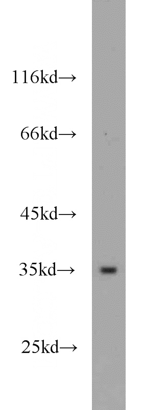 mouse brain tissue were subjected to SDS PAGE followed by western blot with Catalog No:110997(GNB3 antibody) at dilution of 1:1000