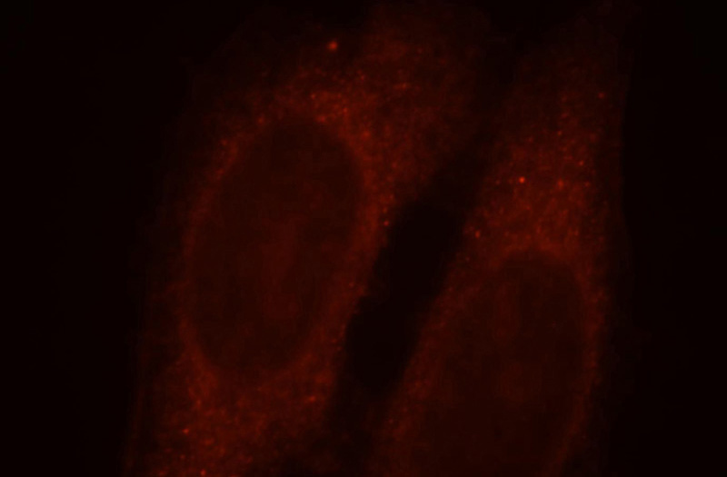 Immunofluorescent analysis of HepG2 cells, using PPP1R9A antibody Catalog No:114093 at 1:25 dilution and Rhodamine-labeled goat anti-rabbit IgG (red).