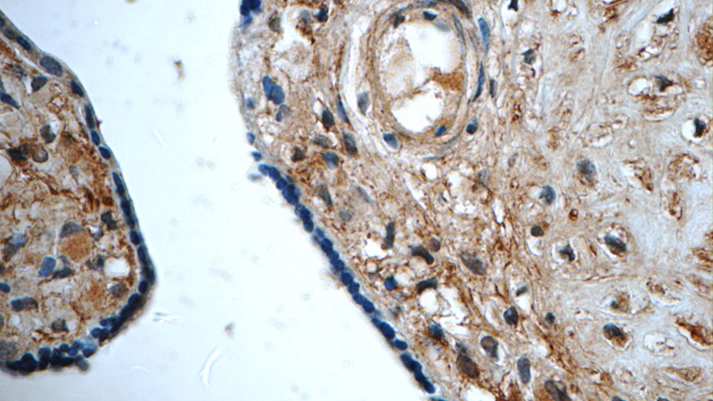 Immunohistochemistry of paraffin-embedded human placenta tissue slide using Catalog No:113892(PGF Antibody) at dilution of 1:50 (under 40x lens)
