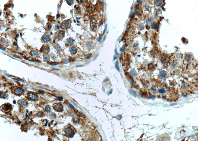 Immunohistochemistry of paraffin-embedded human testis tissue slide using Catalog No:111850(INSL3 Antibody) at dilution of 1:50 (under 40x lens)