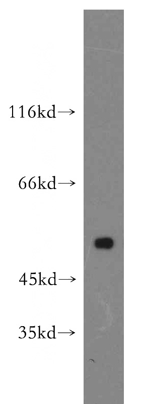 Jurkat cells were subjected to SDS PAGE followed by western blot with Catalog No:111475(HMG20A antibody) at dilution of 1:500