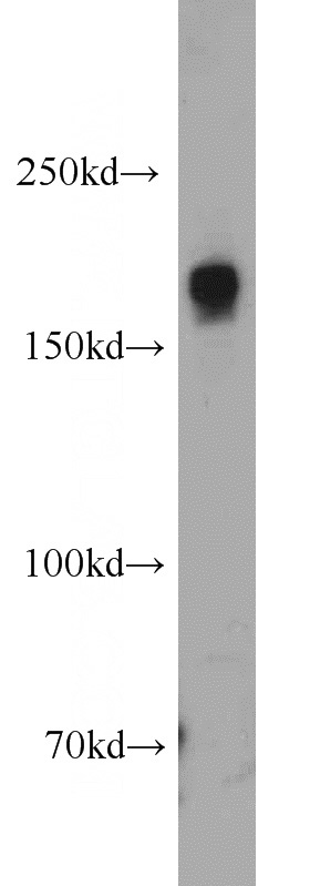 MCF7 cells were subjected to SDS PAGE followed by western blot with Catalog No:115130(SETDB1 antibody) at dilution of 1:1000