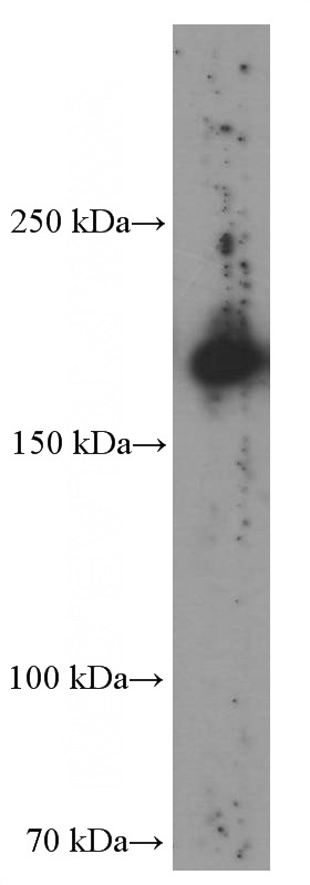 human liver tissue were subjected to SDS PAGE followed by western blot with Catalog No:107052(MRC1 Antibody) at dilution of 1:1000